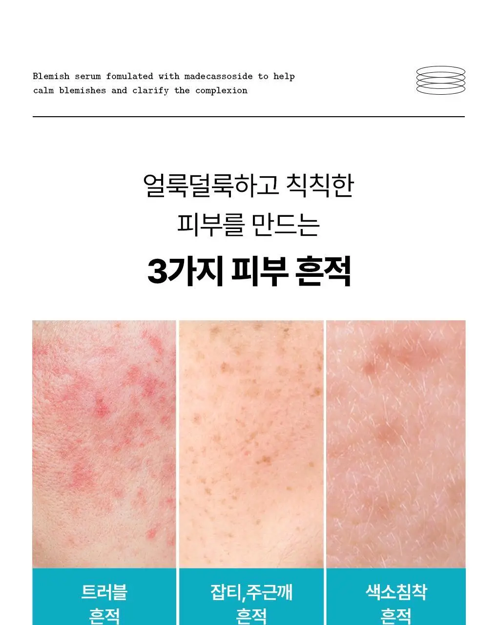 [1등/단품] 메디힐 마데카소사이드 흔적 리페어 세럼 40ml 상세페이지 8